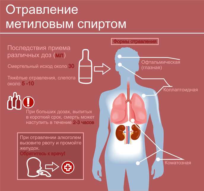 Четвертый признак отравления - наличие симптомов