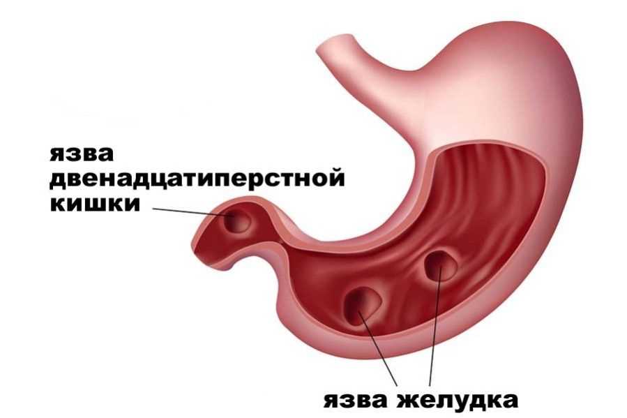 Самая частая болезнь в России