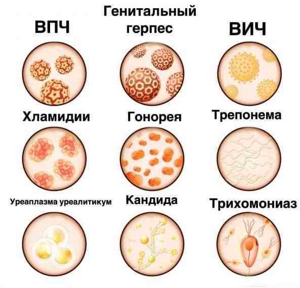 Сердечно-сосудистые заболевания